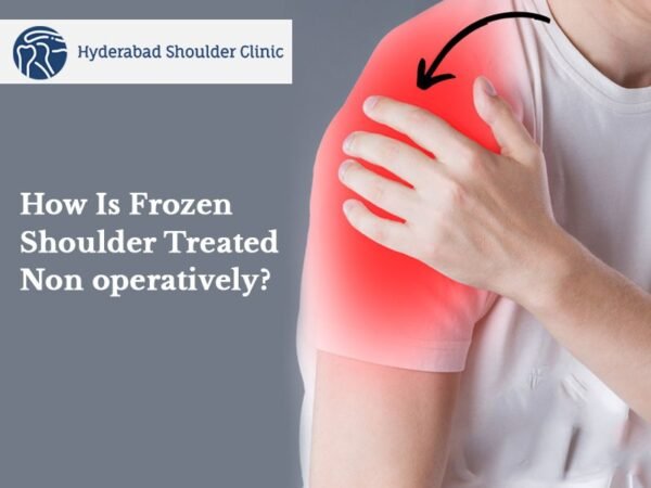 How Is Frozen Shoulder Treated Non Operatively Shoulder Clinic Hyderabad