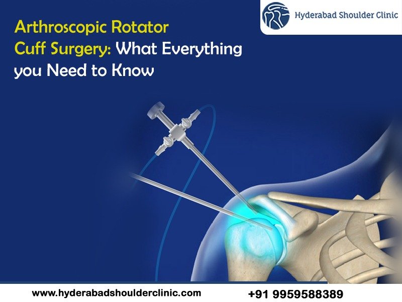 Arthroscopic Rotator Cuff Surgery What Everything You Need To Know