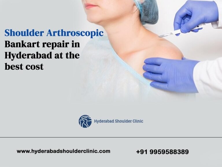 Shoulder Arthroscopic Bankart Repair In Hyderabad At The Best Cost