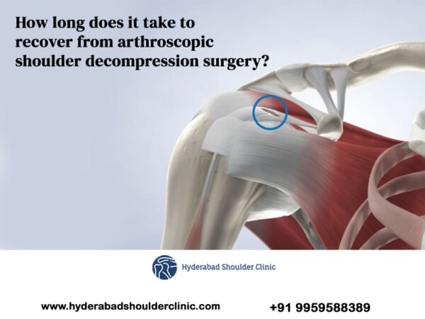 How Long Does It Take To Recover From Arthroscopic Shoulder Decompression Surgery Shoulder