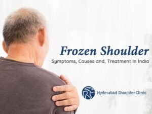 Read more about the article Frozen Shoulder Symptoms, Causes and, Treatment in India