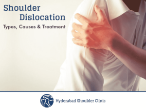 Read more about the article Shoulder Dislocation Types, Causes, and Treatment