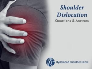 Read more about the article Shoulder Dislocation Questions and Answers