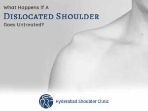 Read more about the article What Happens If A Dislocated Shoulder Goes Untreated?