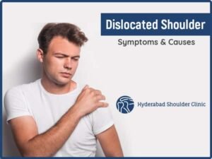 Read more about the article Dislocated Shoulder Symptoms & Causes