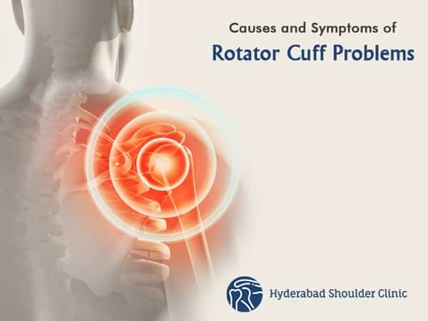You are currently viewing Causes and Symptoms of Rotator Cuff Problems