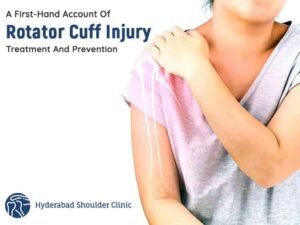 Read more about the article Rotator Cuff Tear: Symptoms, Causes And Treatment