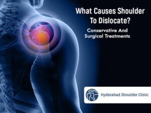 Read more about the article What Causes Shoulder To Dislocate? Conservative And Surgical Treatments