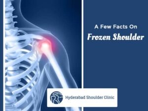 Read more about the article A Few Facts On Frozen Shoulder