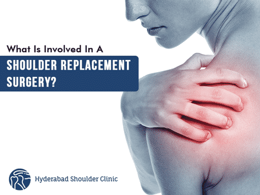 You are currently viewing What Is Involved In A Shoulder Replacement Surgery?