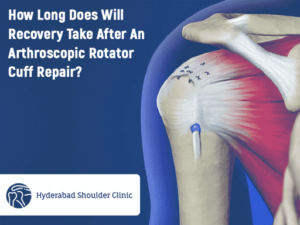 Read more about the article How Long Does Will Recovery Take After An Arthroscopic Rotator Cuff Repair?