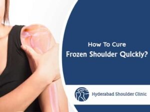 Read more about the article How To Cure Frozen Shoulder Quickly