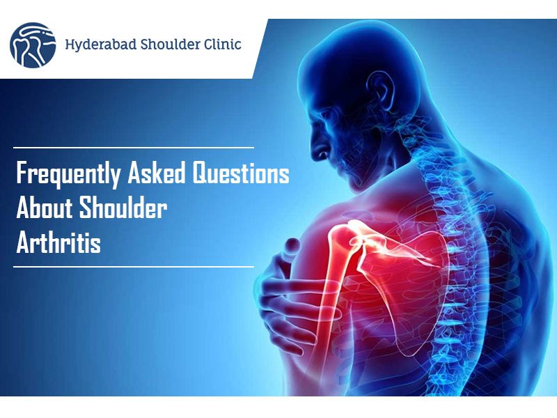 Read more about the article Frequently Asked Questions About Shoulder Arthroscopy