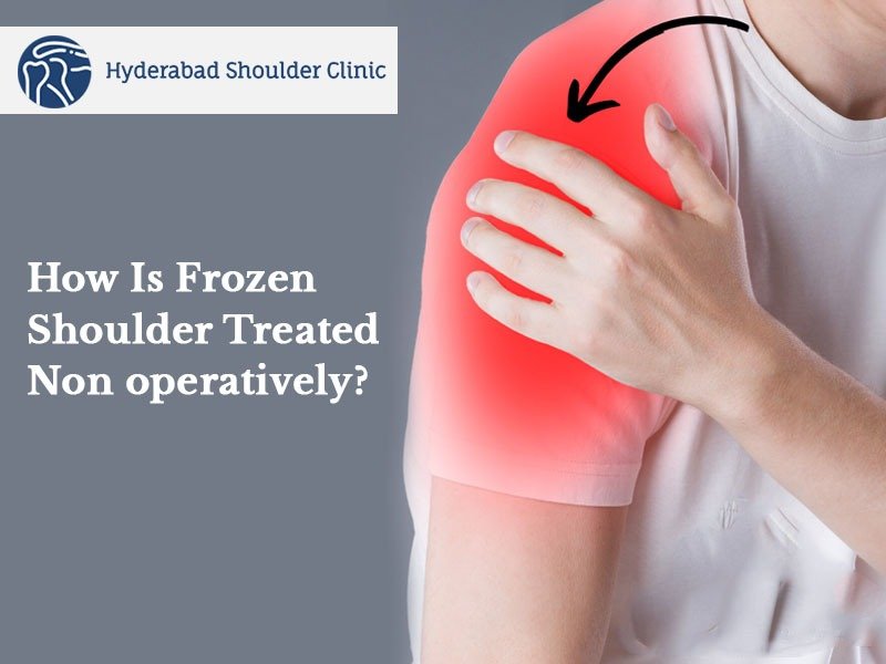 You are currently viewing How Is Frozen Shoulder Treated Non operatively?