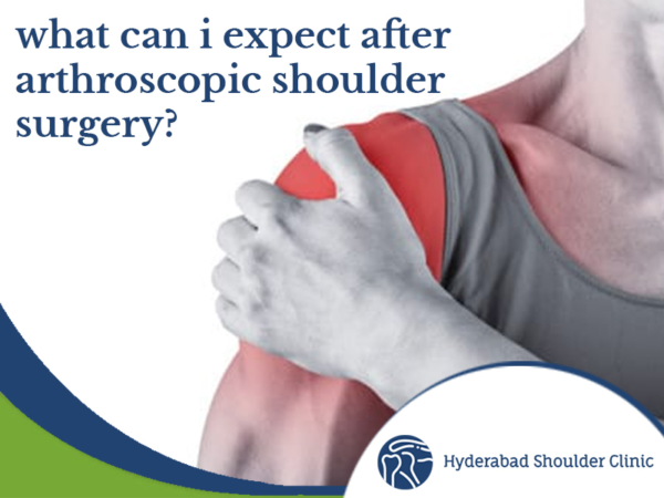 What Can I Expect After Arthroscopic Shoulder Surgery? - shoulder ...