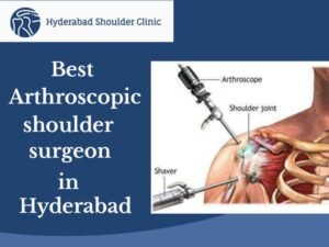 Read more about the article Best Arthroscopic Shoulder Surgeon In Hyderabad