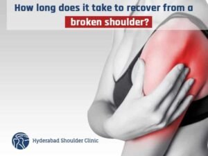 Read more about the article How Long Does It Take To Recover From A Shoulder Fracture?