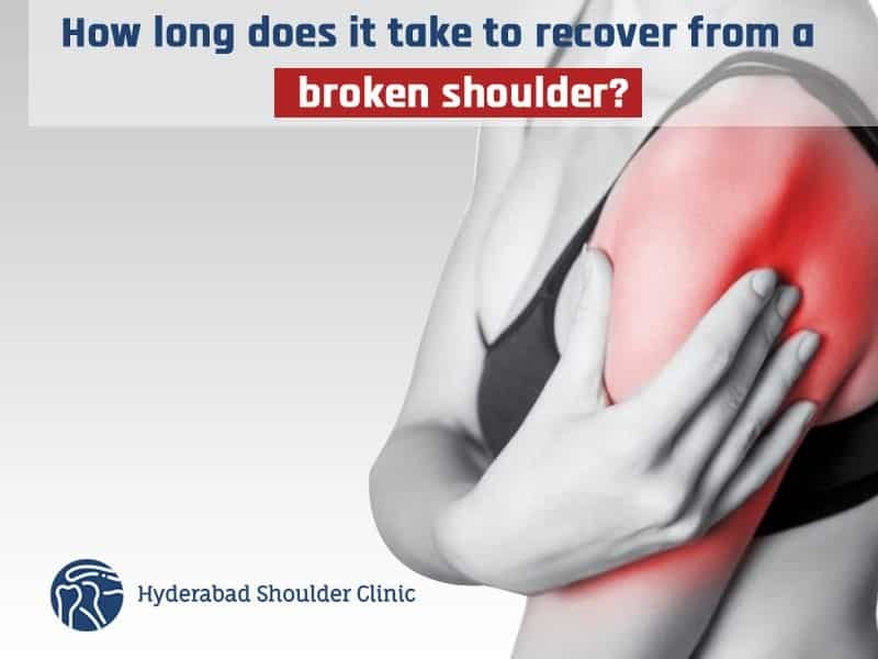 How Long To Recover From Broken Shoulder Surgery