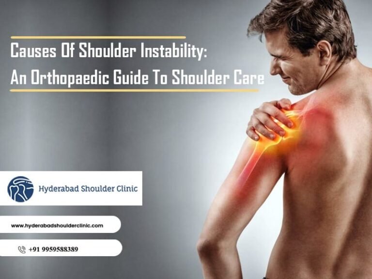 Causes Of Shoulder Instability: An Orthopaedic Guide To Shoulder Care ...