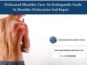 Read more about the article Dislocated Shoulder Care: An Orthopaedic Guide To Shoulder Dislocation And Repair