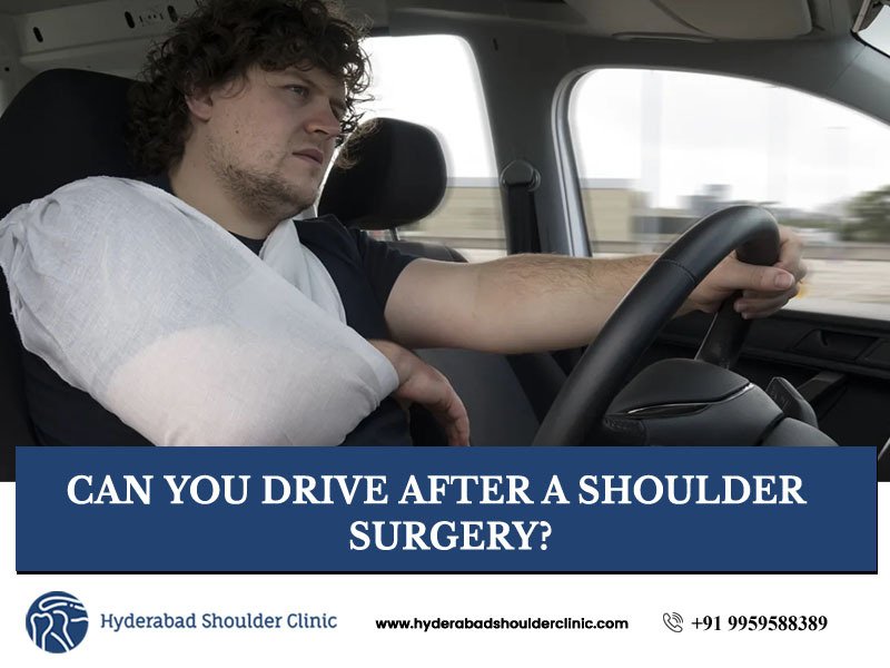 Driving after rotator cuff surgery new arrivals