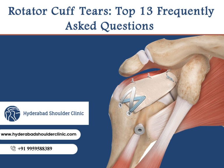 partial rotator cuff tear treatment in Hyderabad - shoulder clinic ...