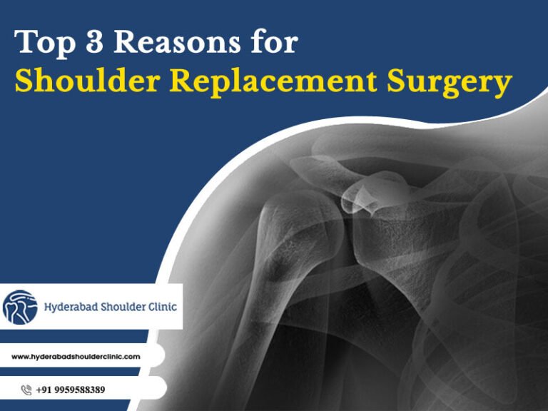 Top 3 Reasons For Shoulder Replacement Surgery - shoulder clinic Hyderabad