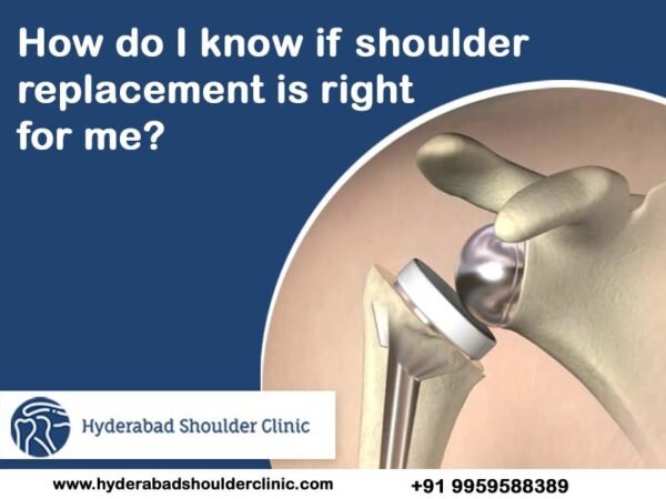 How do I Know If Shoulder Replacement Is Right For Me? - shoulder ...