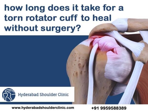 How long does it take for a torn rotator cuff to heal without surgery ...