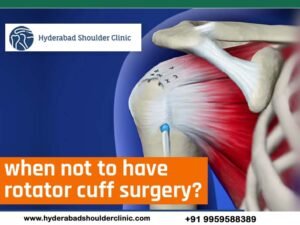 Read more about the article When Not To Have Rotator Cuff Surgery?