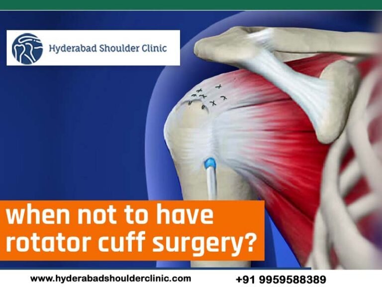 When Not To Have Rotator Cuff Surgery? - shoulder clinic Hyderabad