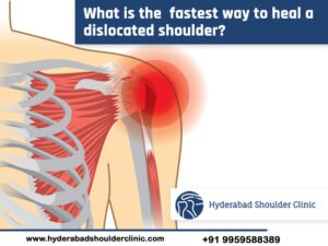 Read more about the article Do you know What Is The Fastest Way To Heal A Dislocated Shoulder?