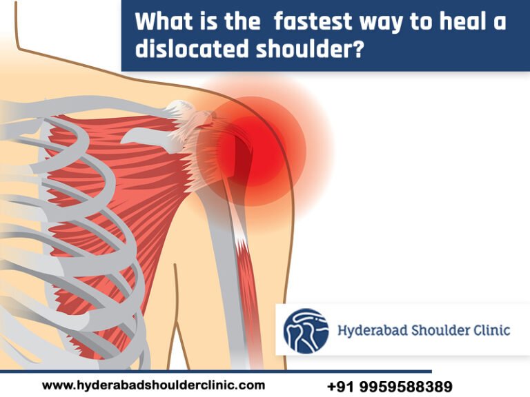 do-you-know-what-is-the-fastest-way-to-heal-a-dislocated-shoulder