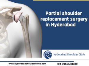 Read more about the article Partial Shoulder Replacement Surgery In Hyderabad