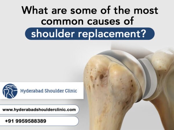 What Are Some Of The Most Common Causes Of Shoulder Replacement 