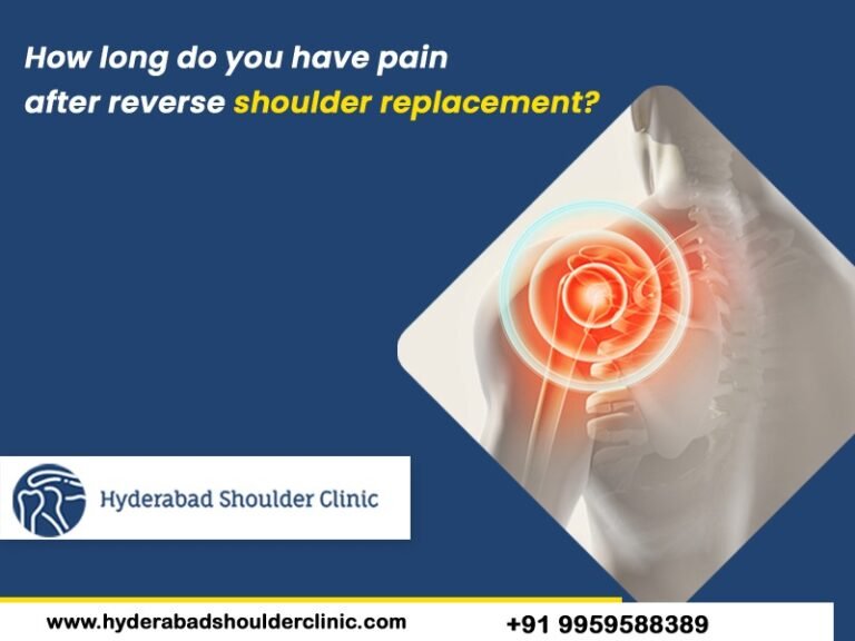 how-long-does-the-pain-last-after-reverse-shoulder-replacement