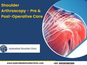 Read more about the article Shoulder Arthroscopy – Pre & Post-Operative Care