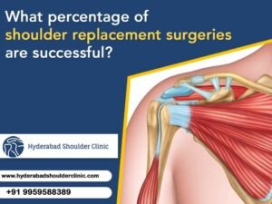 Read more about the article What percentage of shoulder replacement surgeries are successful?