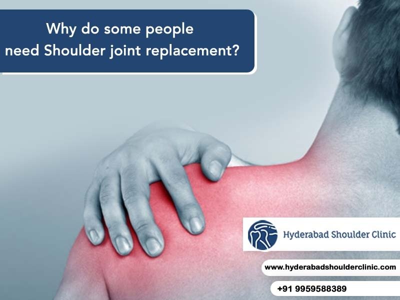 You are currently viewing Why do some people need shoulder joint replacement?