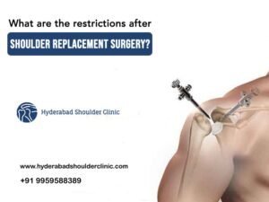 Read more about the article What are the restrictions after shoulder replacement surgery?