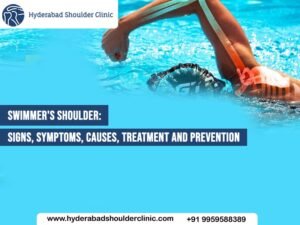Read more about the article Swimmer’s Shoulder: Causes, Symptoms, Treatment, and Prevention