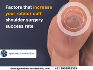 Read more about the article Factors that increase your rotator cuff shoulder surgery success rate