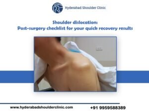 Read more about the article Shoulder dislocation: Post-surgery checklist for your quick recovery results