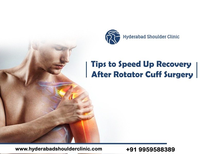 Read more about the article Tips to Speed Up Recovery After Rotator Cuff Surgery