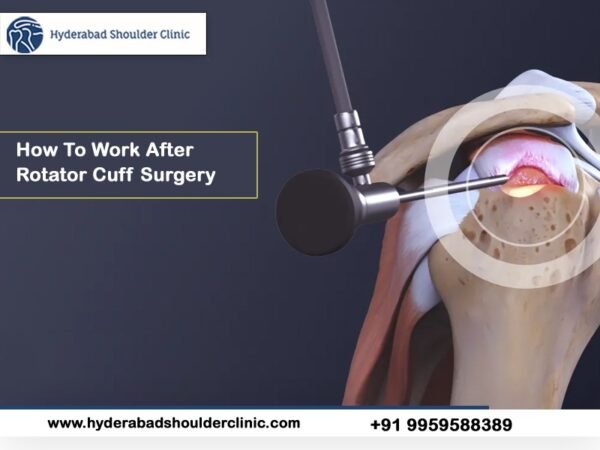 How To Work After Rotator Cuff Surgery Shoulder Clinic Hyderabad 