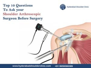 Read more about the article Top 10 Questions To Ask your Shoulder Arthroscopic Surgeon Before Surgery
