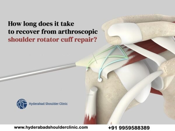 how-long-does-it-take-to-recover-from-arthroscopic-shoulder-rotator