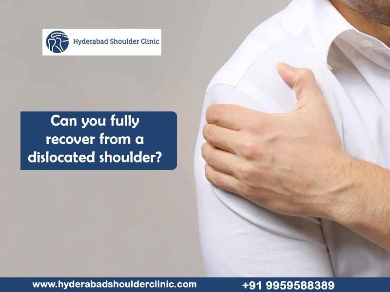 You are currently viewing Can you fully recover from a dislocated shoulder?