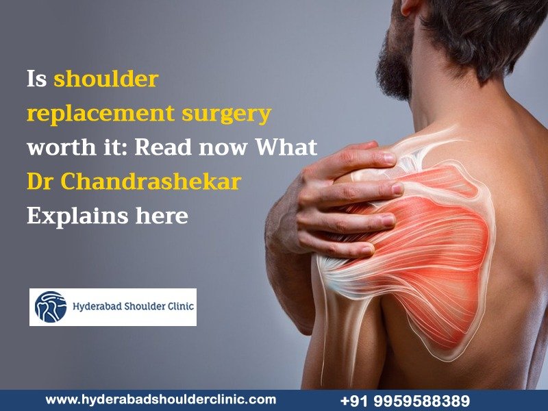 Read more about the article Is shoulder replacement surgery worth it: Read now What Dr Chandrashekar Explains here