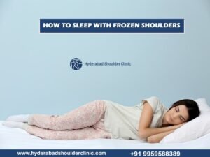 Read more about the article How to sleep with frozen shoulders